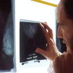 How to Prepare for a Mammogram: Essential Tips