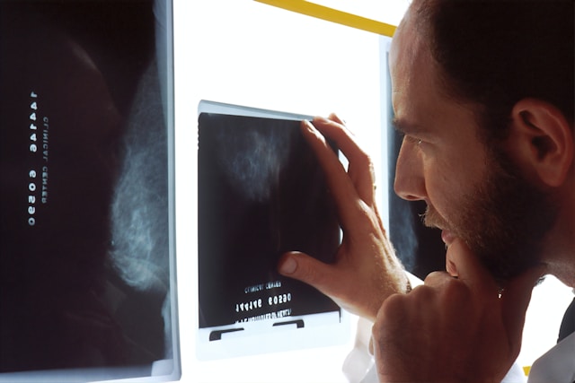 How to Prepare for a Mammogram: Essential Tips