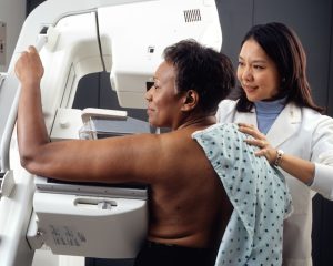 Things I Wish I Knew Before Mammogram: Vital Insights