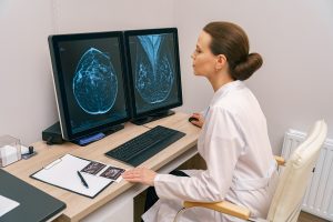 Understanding Repeats and Rejects in Mammography